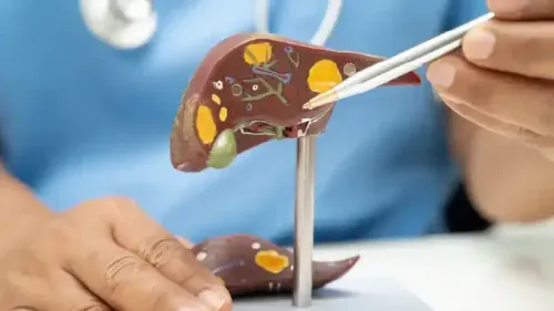 Gallbladder Stone Surgery Cost in Hyderabad